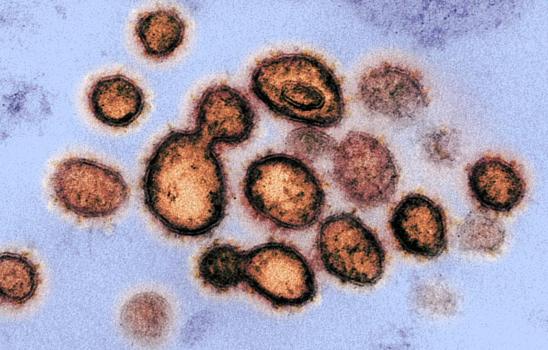 What is Coronavirus Covid-19