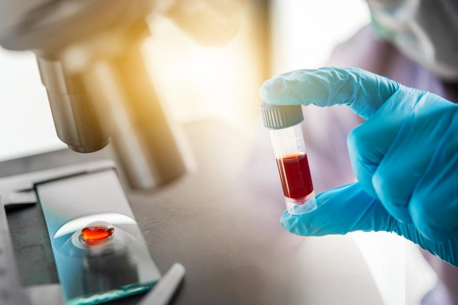 What are Coronavirus Antibody Blood Tests